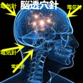 高次脳機能障害